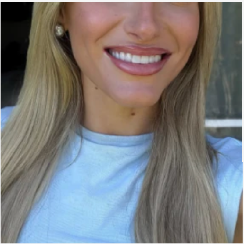 Noovea LuxeSmile Set | Brighten Your Smile with Ease