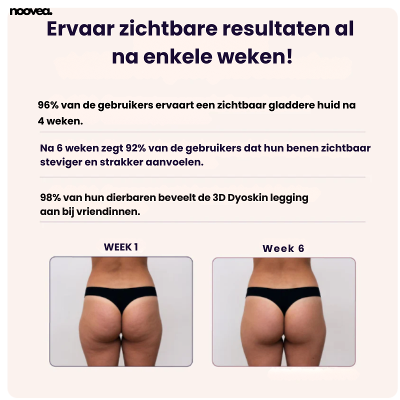 3D Legging – Noovea | Push-up, Slankere Taille & Luxe Comfort