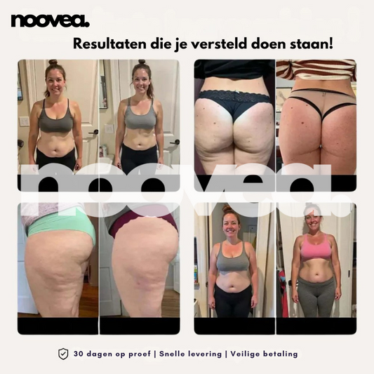 3D Legging – Noovea | Push-up, Slankere Taille & Luxe Comfort